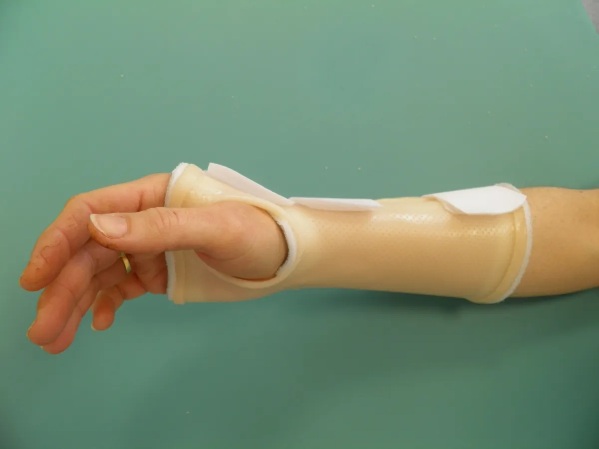 immobilisation_poignet_fracture immobilisation_poignet_fracture