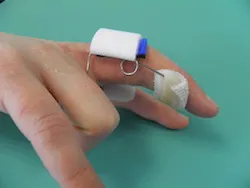 orthèse dynamique type capener
